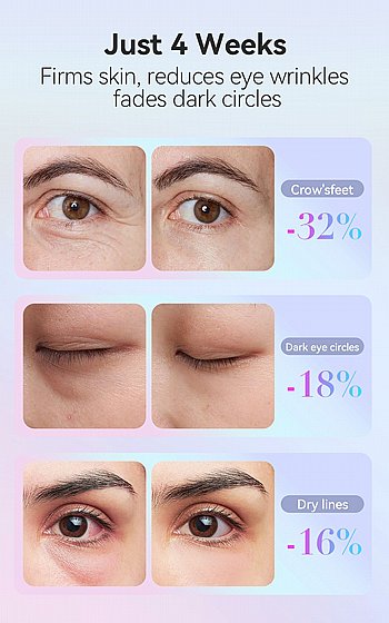 Anti wrinkle eye massager  ������ ���� �����������  EMS , ���� ��� ������� ������, ������ ������� ��� TB-1883
